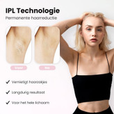 لیزر خانگی فیلیپس لومیا مدل Philips Lumea Prestige9900 IPLشات نامحدود اصل اورجینال به ضمانت اصالت کالا بهمراه کیف عینک ژیلت